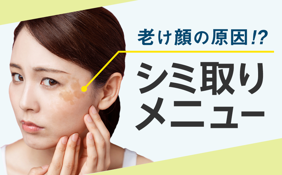 顔のシミ しみ を消したい 静岡のシミ取りメニュー 静岡県の女性向け情報サイト Womo