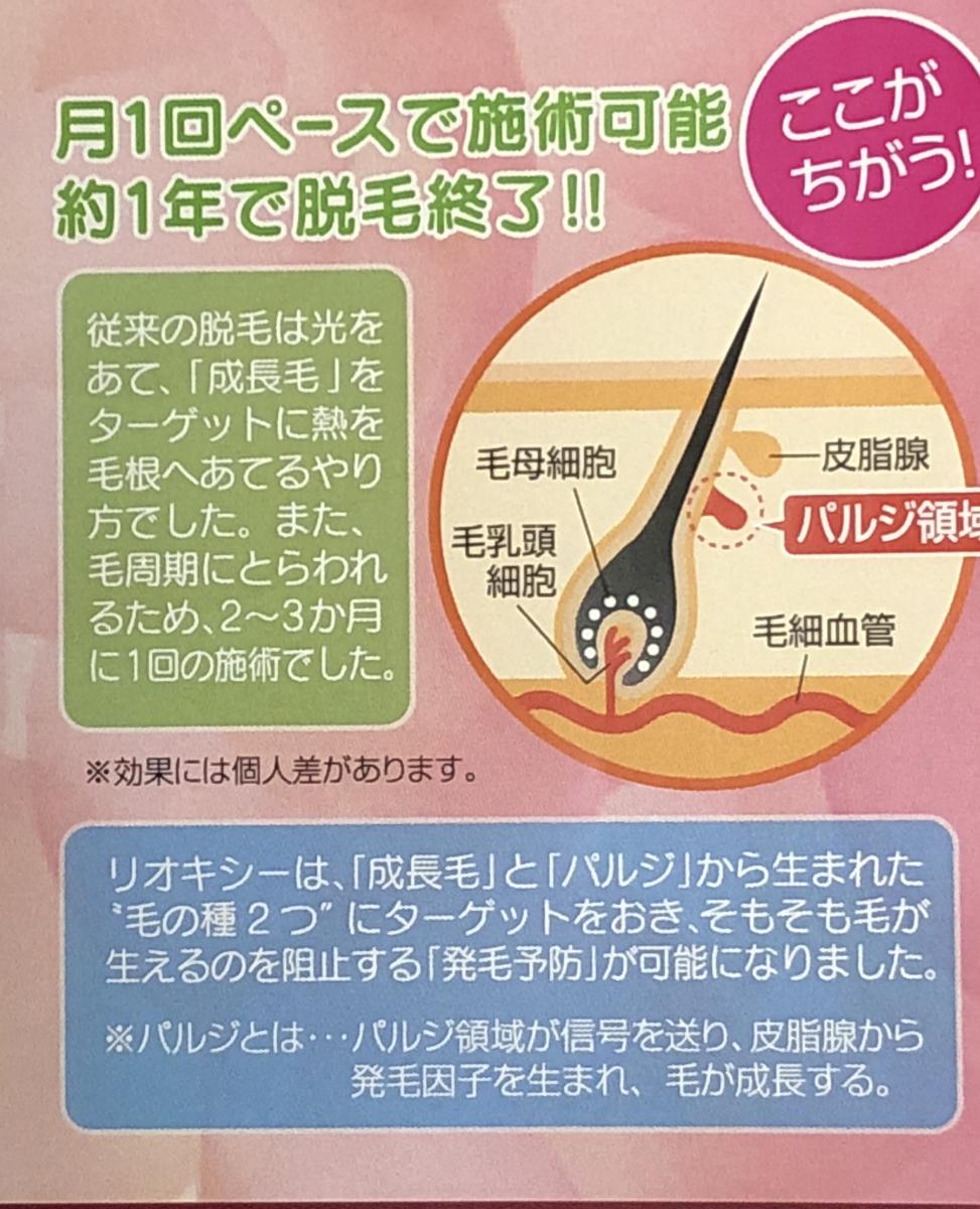 脱毛 Sパーツの導入キャンペーン価格¥1,100のイメージ